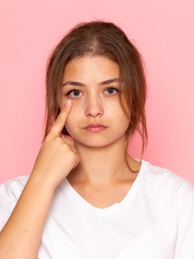 swelling under the eyes of a girl